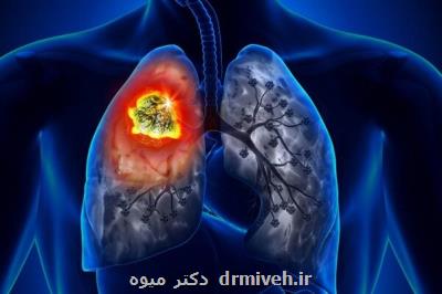 ارتباط آلودگی هوا با افزایش مبتلا شدن به سرطان ریه
