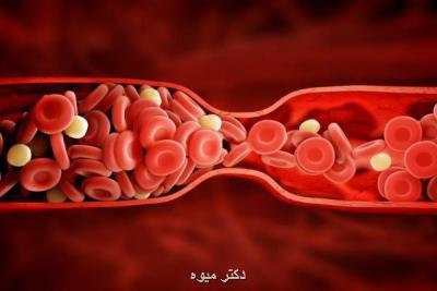 کرونا احتمال لختگی خون پس از جراحی را 90 درصد می افزاید