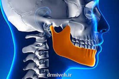 درد فک در دوره یائسگی زنان تشدید می شود
