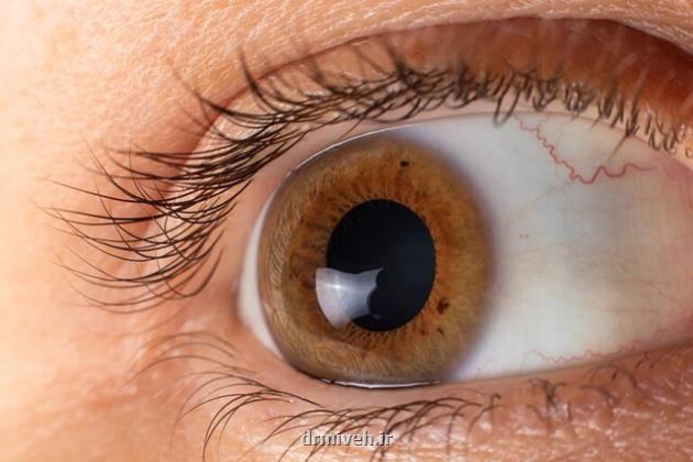 ۶ بیماری مهم که چشم ها در مورد آنها هشدار می دهند