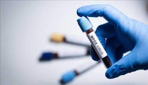 ام پاکس در کشورهای بیشتری شناسایی شده است