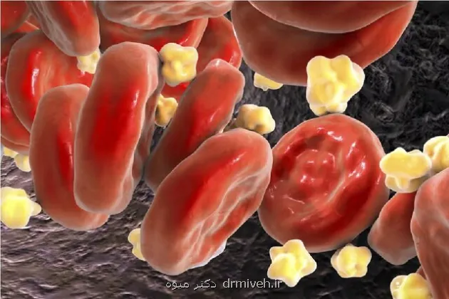 کلسترول بالا در جوانان زنگ خطری که نباید نادیده گرفت