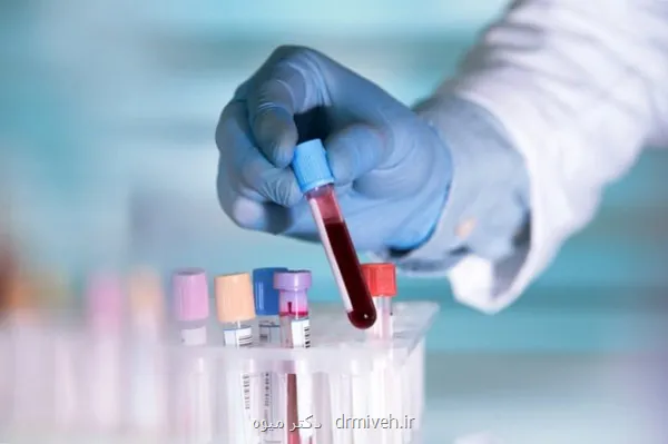 تاثیر آزمایش خون مبتنی بر DNA بر درمان سرطان گلو