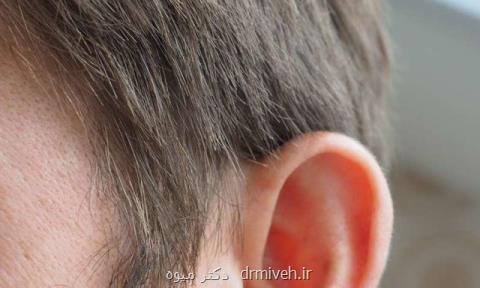 مصرف خودسرانه دارو به سلامت شنوایی صدمه می زند