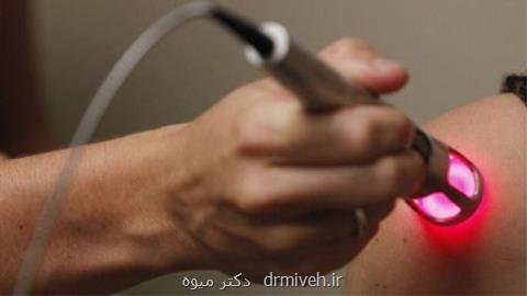 درخواست انجمن متخصصان پوست برای شناسنامه دار شدن دستگاه های لیزر وارداتی