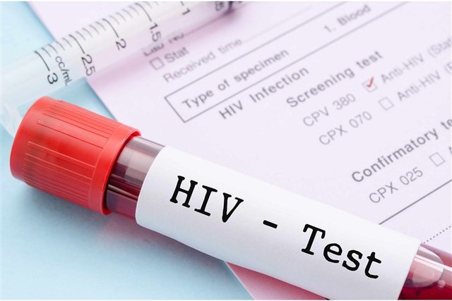 چه كسی باید آزمایش تشخیص ایدز بدهد؟