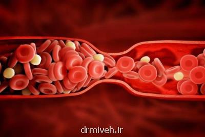 سندروم متابولیك سبب بروز مجدد لختگی خون می شود