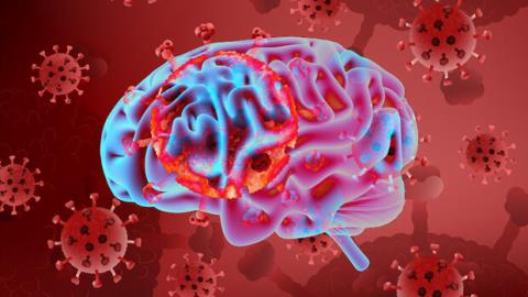 بیماری كووید ۱۹ می تواند منجر به صدمه های مغزی شود