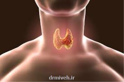 كم كاری تیروئید را چگونه درمان كنیم؟